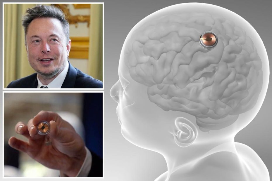 FDA approves Elon Musk's Neuralink implants for humans test