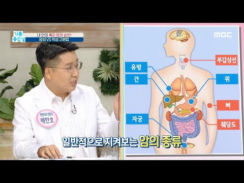 [기분 좋은 날] 양성종양&악성종양 구분법, MBC 210824 방송